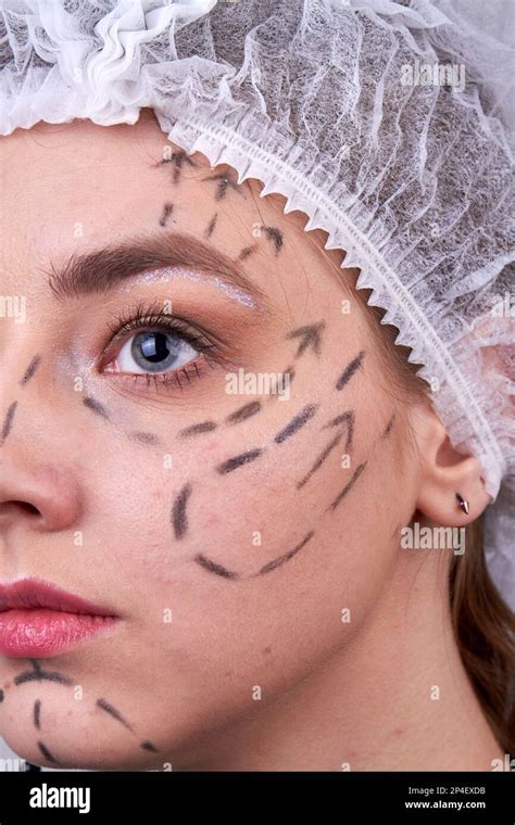 Vertical Shot Of Womans Face With Dotted Lines Face Lift Surgery Stock