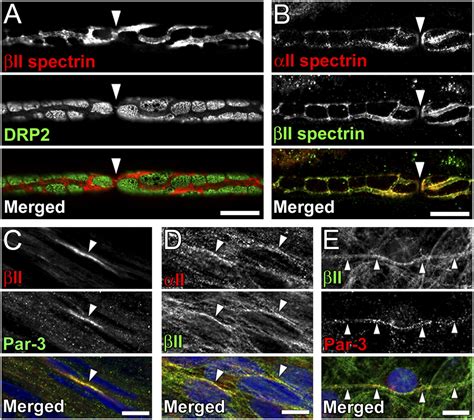 Schwann Cell Spectrins Modulate Peripheral Nerve Myelination Pnas