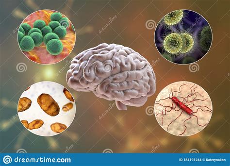 Etiology Of Bacterial Meningitis Stock Illustration Illustration Of