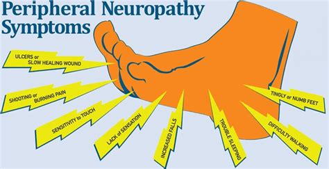 New Advancements In Peripheral Neuropathy Treatment Genesis