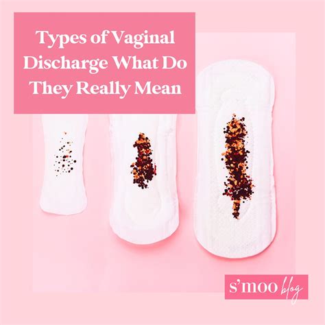 Types Of Vaginal Discharge What Do They Really Mean Smoo