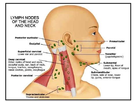 How To Drain A Lymph Node In The Neck Best Drain Photos Primagemorg