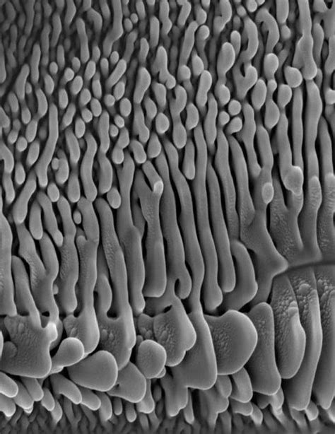 Coral Like Microstructure Electron Microscope Microscopy Microscope
