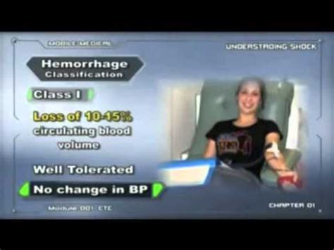 Mathematical modeling has been applied in this context for decades; Hemorrhagic Shock training video - YouTube