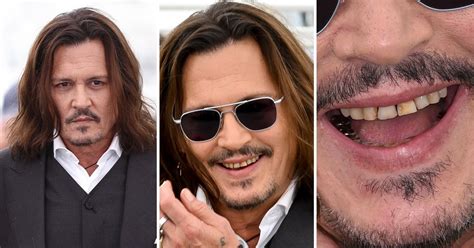 Fans Were Shocked By Johnny Depp S Rotten Teeth At Cannes They