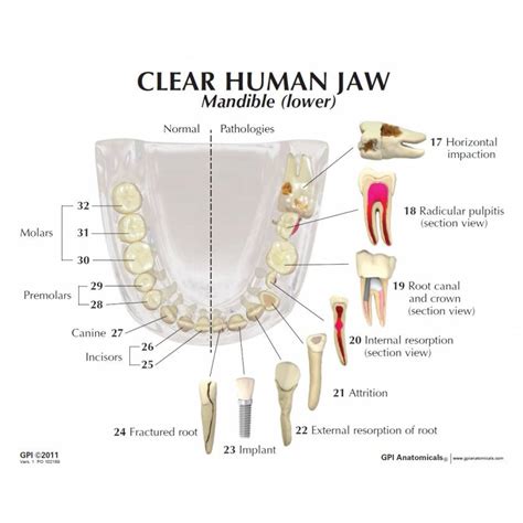Gpi 2861 Clear Human Jaw With Teeth Model