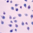 Giardia lamblia trophozoite | Medical Laboratories