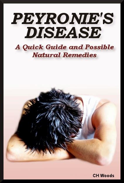 Free Ebooks On Health Free Ebook Peyronies Disease A Quick Guide