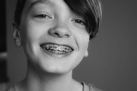 Braces For Kids—how Can Parents Help Their Children Pike District Smiles