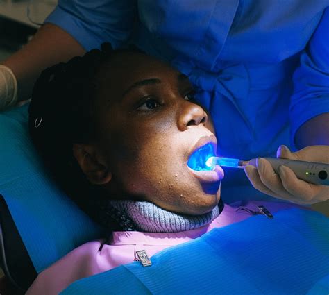 does teeth whitening cause sensitivity and how you can deal with it