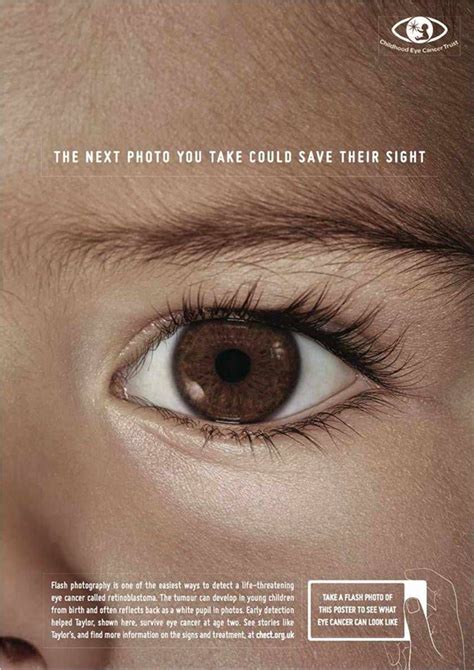 Childhood Eye Cancer Trust Flash Photography Ad Ruby
