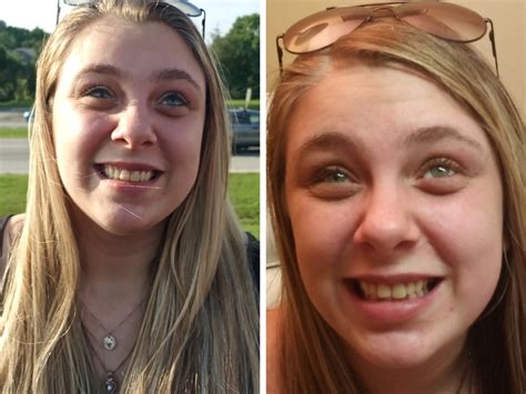 Kaylee Muthart Who Tore Out Her Own Eyeballs While High On Meth Gets