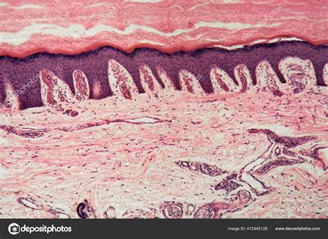 Human Skin Sweat Glands Microscope Stock Photo By ©chweiss 472445128