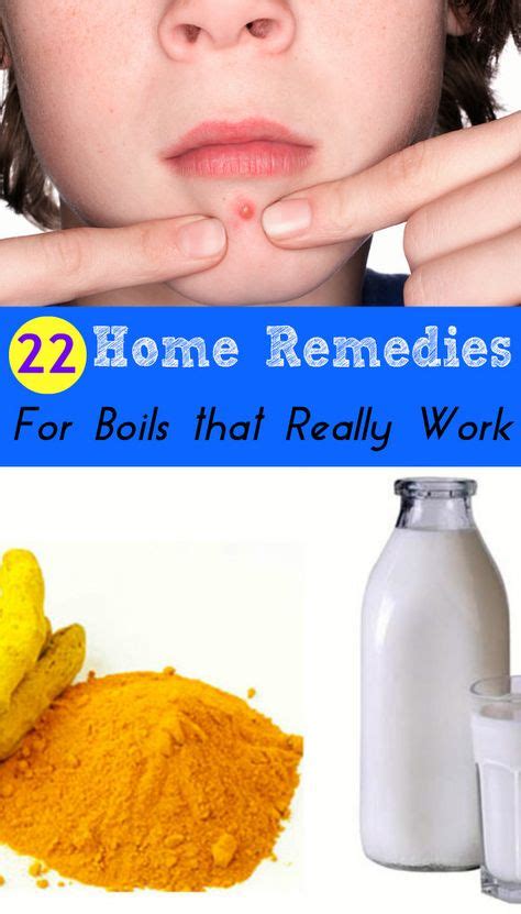 Effective Home Remedies To Get Rid Of Boil Youtube