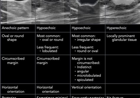 Breast Ultrasound How To Interpret The Results Healthy Food Near Me