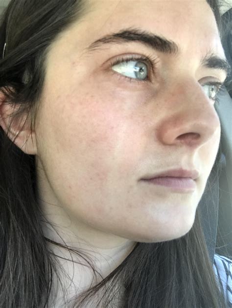 Anyone Know What This Streak Down My Face Is From I Dont Wear Makeup
