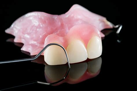 4 Types Of Partial Dentures Available With Online Dental Labs