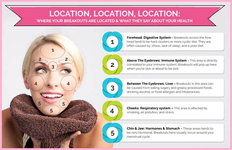 Acne Face Map 2022 Forehead Acne Breakout And Other Face Location
