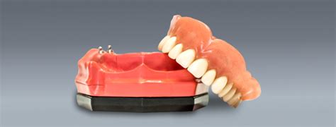 Implant Retained Dentures South Calgary Denture And Implant Clinic