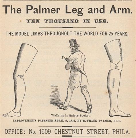 Prosthetic Limbs Civil War Amputee Vintage By Gospelhymnsvintage