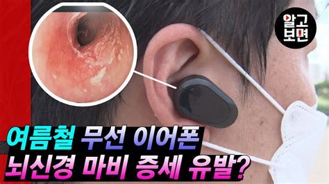 여름철 무선 이어폰을 장시간 사용하면 ‘외이도염‘에 걸릴 수 있다는 수상한 소문 확인 Youtube