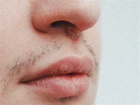 Cold Sore Under Nose Symptoms Causes Treatments And More