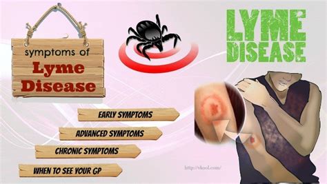 4 common signs and symptoms of lyme disease in adults