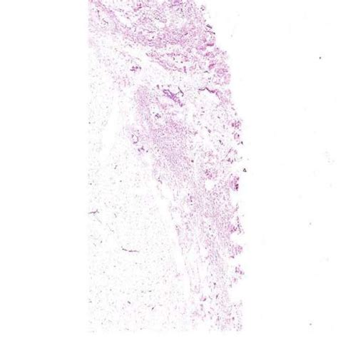 Hyaline Cartilage Histology Slide For Chemical Laboratory At Rs 500