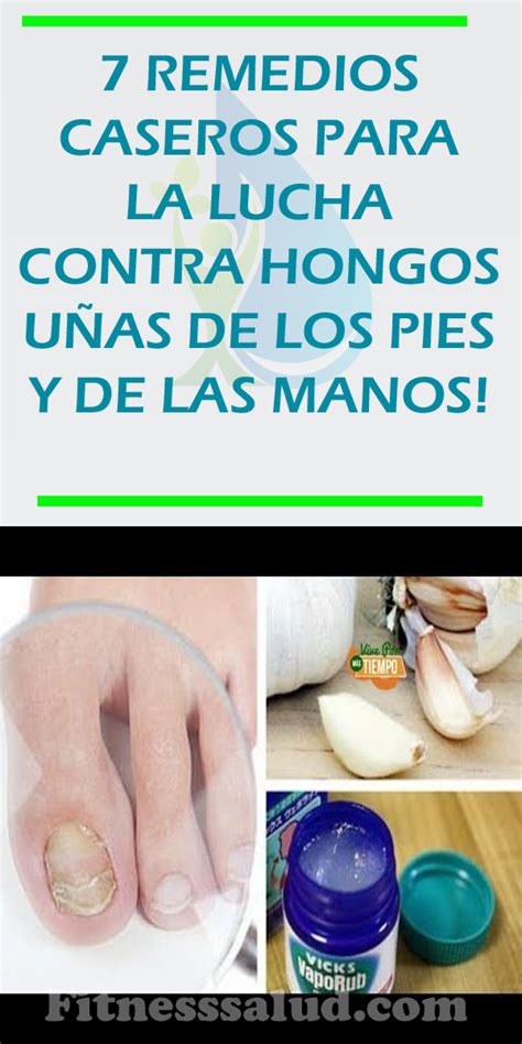 7 REMEDIOS CASEROS PARA LA LUCHA CONTRA HONGOS UÑAS DE LOS PIES Y DE