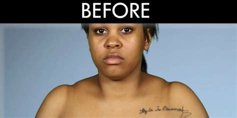 Woman With Dramatically Uneven Breasts Gets Surgery To Correct Them On Botched By Nature