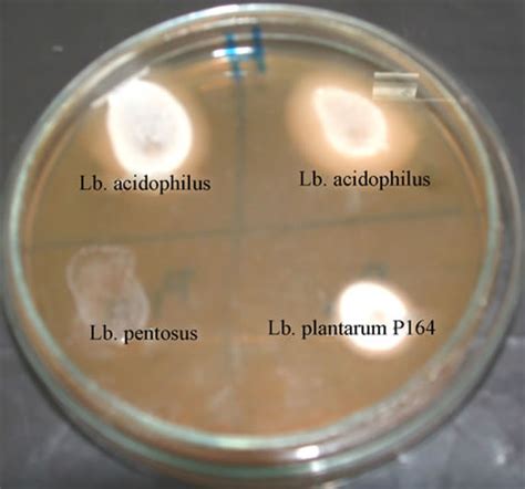 Lactobacillus Colony Morphology On Blood Agar Sexiz Pix