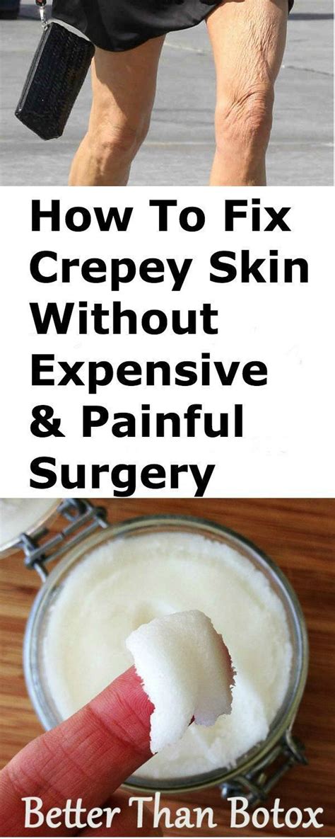 Aim for a combination of cardio at least three times a week in the form of brisk walking or elliptical training and weight training, focusing on arms and legs. How to Get Rid of Crepey Skin on Legs & Arms Without ...