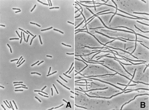 Fusobacterium Scheda Batteriologica Ed Approfondimenti