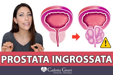 L Ipertrofia Prostatica Benigna Carlotta Gnavi Health Coach