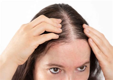 Best Ways Hide Thinning Hair At The Front How To Make The Front Of