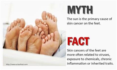 How To Detect Skin Cancer On Your Feet Tanglewood Foot Specialists