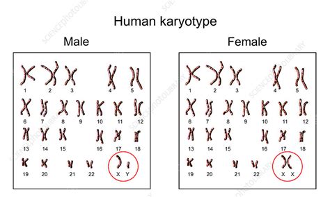 Human Chromosomes Male Vs Female Karyotype Illustration Stock Image