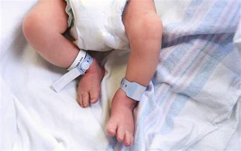 Circuncisión Bebé Babysitio