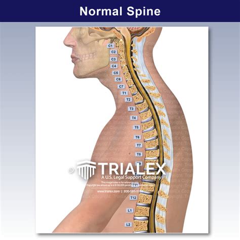 Normal Spine Trialexhibits Inc