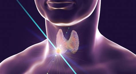 Thyroid Surgery Affinity Surgery Medical Surgery Clinic Singapore