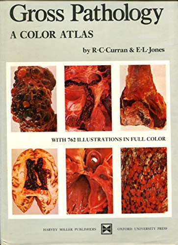 Gross Pathology A Color Atlas Curran R C Jones E L