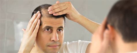 Top More Than 155 Severe Hair Fall Reasons Super Hot Dedaotaonec