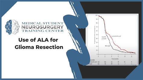 Use Of Ala For Glioma Resection Youtube