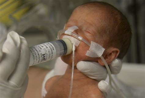 Very Premature Babies Have Lower Iqs Suffer Academically