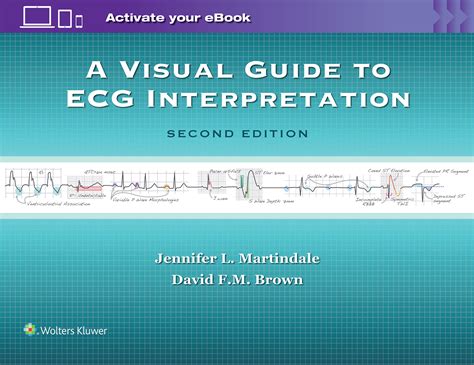 A Visual Guide To Ecg Interpretation By Jennifer L Martindale Goodreads