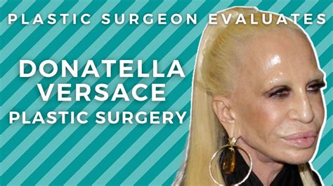 Donatella Versace Before And After Plastic Surgery Silicone Disaster Oasis Medical Aesthetics