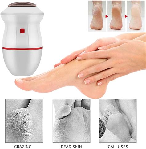 Electric Vacuum Adsorption Foot File Callus Grinder Dead Skin Remover