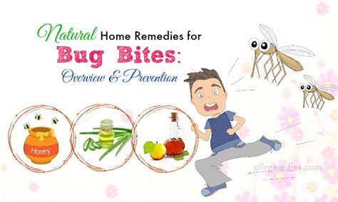 Top 19 Natural Home Remedies For Bug Bites Overview And Prevention