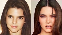 La evolución de Kendall Jenner, antes y después de la fama (Fotos ...