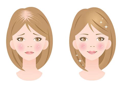 Woman With Thinning Hair Illustrations Royalty Free Vector Graphics And Clip Art Istock